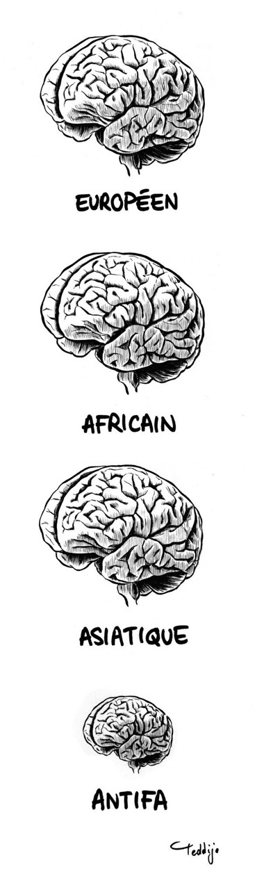 Cerveaux différents